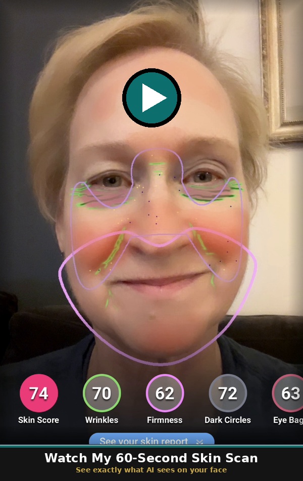 Leslie Hocker's Intelli-SKIN scan result — click to watch